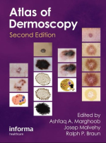 An Atlas of Dermoscopy 2nd Edition PDF EPUB EBOOK