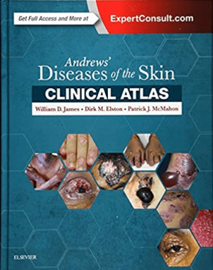 Andrews' Diseases of the Skin Clinical Atlas 1st Edition By William James PDF EPUB EBOOK