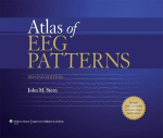 Atlas of EEG Patterns 2nd Edition by John M. Stern eBook