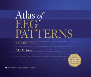 Atlas of EEG Patterns 2nd Edition by John M. Stern eBook