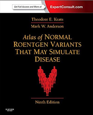 Atlas of Normal Roentgen Variants That May Simulate Disease 9th Edition PDF EPUB EBOOK