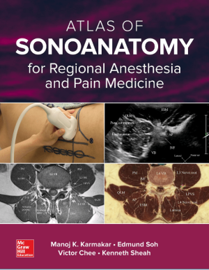 Atlas of Sonoanatomy for Regional Anesthesia and Pain Medicine 1st Edition eBook