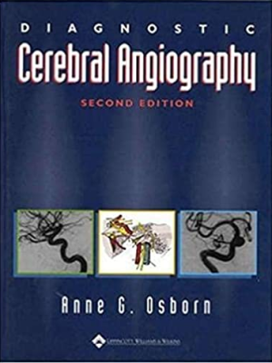 Diagnostic Cerebral Angiography 2nd Edition eBook