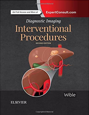 Diagnostic Imaging Interventional Procedures eBook