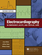 Electrocardiography in Emergency, Acute, and Critical Care By Amal Mattu eBook PDF EPUB