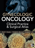 Gynecologic Oncology Clinical Practice and Surgical Atlas 1st Edition eBook