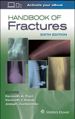 Handbook of Fractures 6th Edition By Kenneth Egol PDF EBOOK EPUB