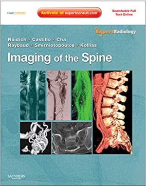 Imaging of the Spine Expert Radiology Series 1st Edition eBook