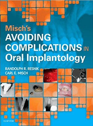 Misch's Avoiding Complications in Oral Implantology 1st Edition eBook