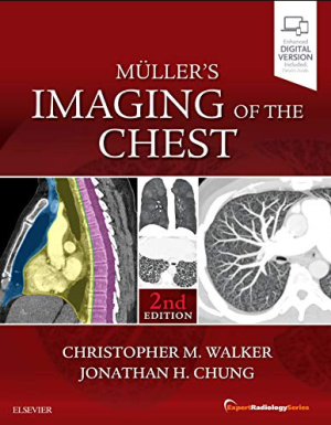 Muller's Imaging of the Chest Expert Radiology Series 2nd Edition PDF EPUB EBOOK