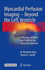 Myocardial Perfusion Imaging – Beyond the Left Ventricle M. Elizabeth Oates, ISBN-13: 978-3319254340