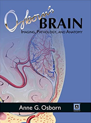 Osborn's Brain 1st Edition by Anne G. Osborn EPUB PDF EBOOK