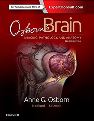 Osborn's Brain 2nd Edition by Anne G. Osborn EPUB PDF EBOOK