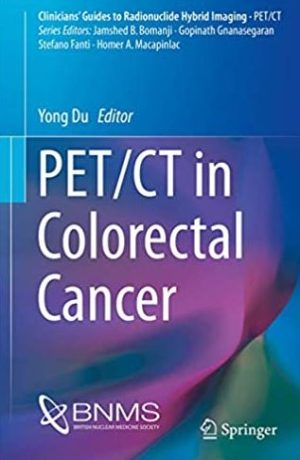 PET/CT in Colorectal Cancer 1st Edition Yong Du, ISBN-13: 978-3319548364