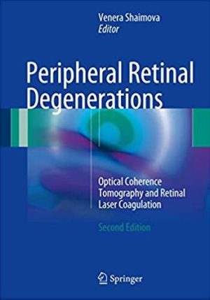 Peripheral Retinal Degenerations: Optical Coherence Tomography and Retinal Laser Coagulation