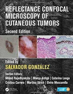Reflectance Confocal Microscopy of Cutaneous Tumors 2nd Edition, ISBN-13: 978-1498757607