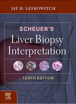 Scheuer's Liver Biopsy Interpretation 10th Edition eBook