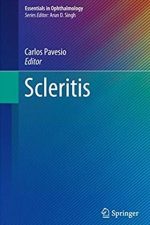 Scleritis (Essentials in Ophthalmology) 2017 Edition Carlos Pavesio, ISBN-13: 978-3319499130