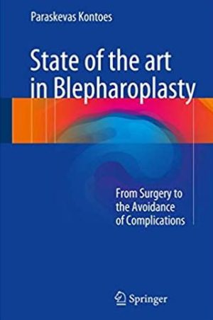 State of the art in Blepharoplasty: From Surgery to the Avoidance of Complications, ISBN-13: 978-3319526416