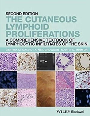 The Cutaneous Lymphoid Proliferations: A Comprehensive Textbook of Lymphocytic Infiltrates of the Skin 2nd Edition, ISBN-13: 978-1118776261