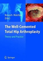 The Well-Cemented Total Hip Arthroplasty: Theory and Practice, ISBN-13: 978-3540241973