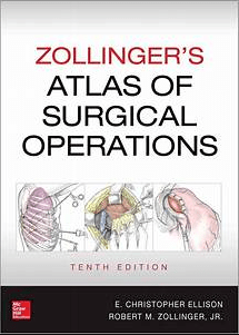 Zollinger's Atlas of Surgical Operations, Tenth Edition 10th Edition PDF EPUB EBOOK