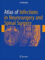 Atlas of Infections in Neurosurgery and Spinal Surgery 1st Edition, ISBN-13: 978-3319600857