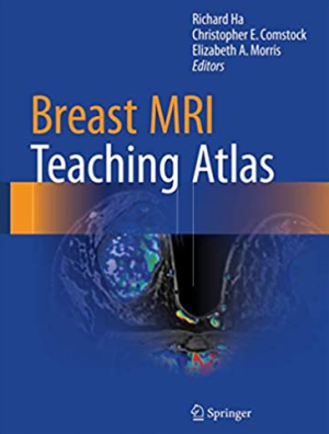 Breast MRI Teaching Atlas 2017 Edition by Richard Ha, ISBN-13: 978-1493964079