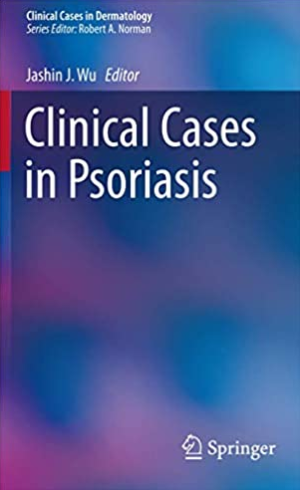 Clinical Cases in Psoriasis 1st Edition by Jashin J. Wu, ISBN-13: 978-3319527789